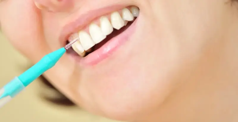 Chirurgia stomatologiczna Warszawa