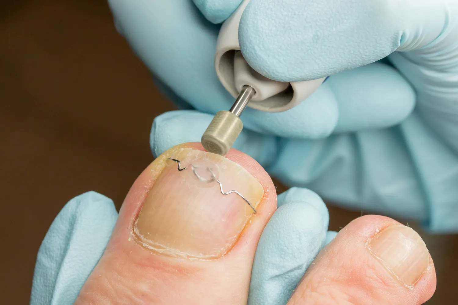 Pedicure leczniczy Warszawa