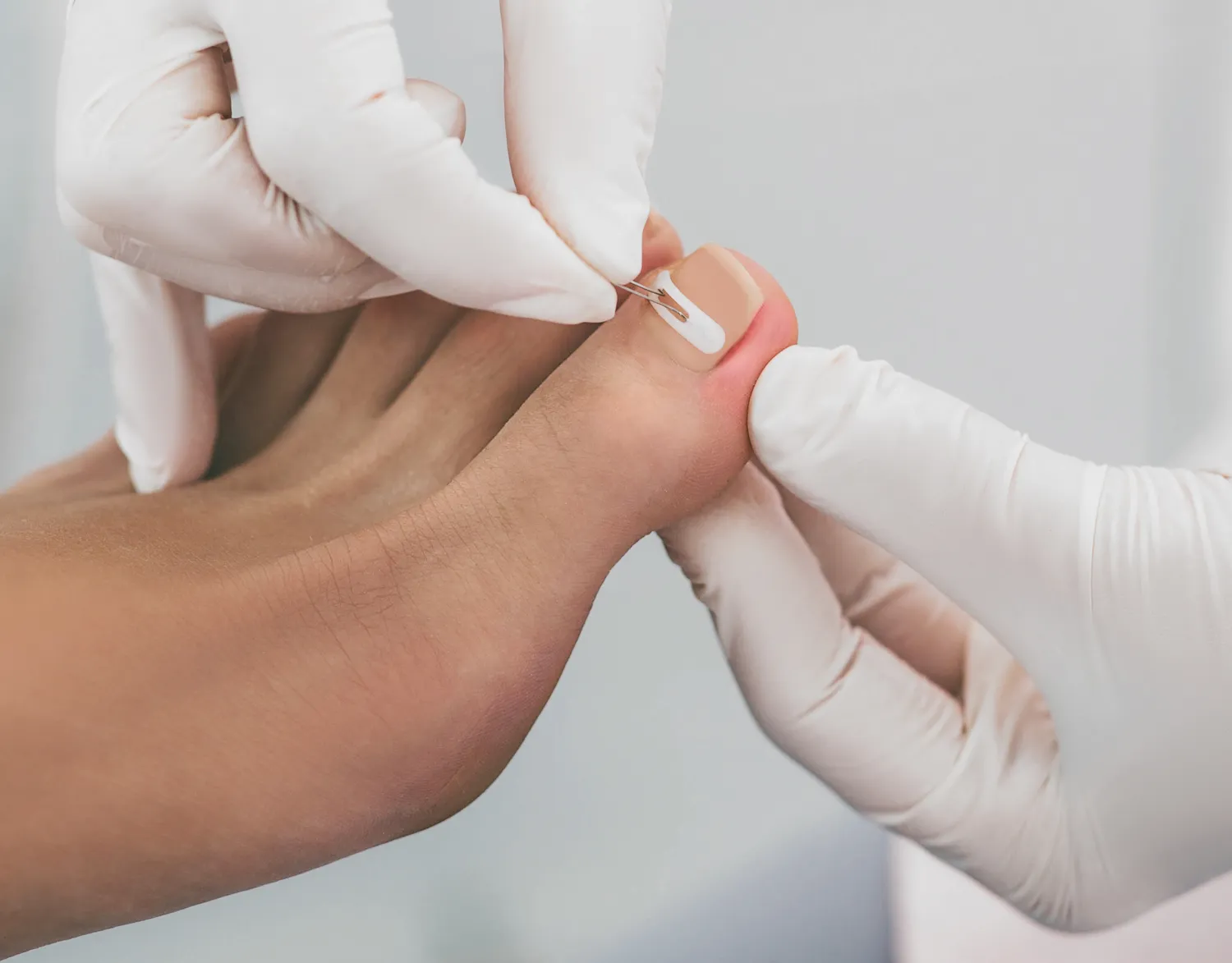 Pedicure podologiczne Szczecin
