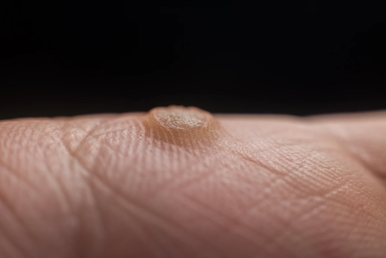 Czym jest podologia i jak można zostać podologiem?